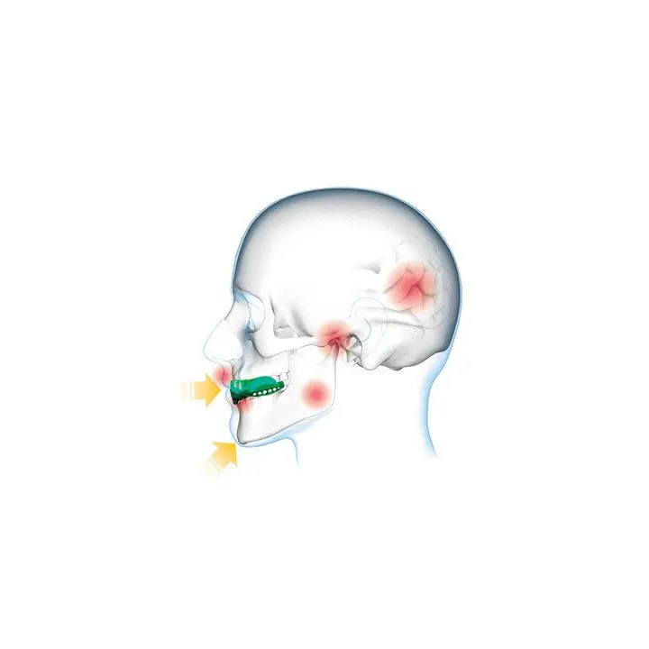 Protège-dents Shock Doctor Gel Max Power Carbon Trans Bleu